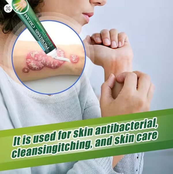⁦Sumifun الطب الصدفية الصينية كريم العناية بالبشرة لالتهاب الجلد الأكزيما العلاج الشرى الطبية المضادة للحكة مرهم⁩ - الصورة ⁦3⁩