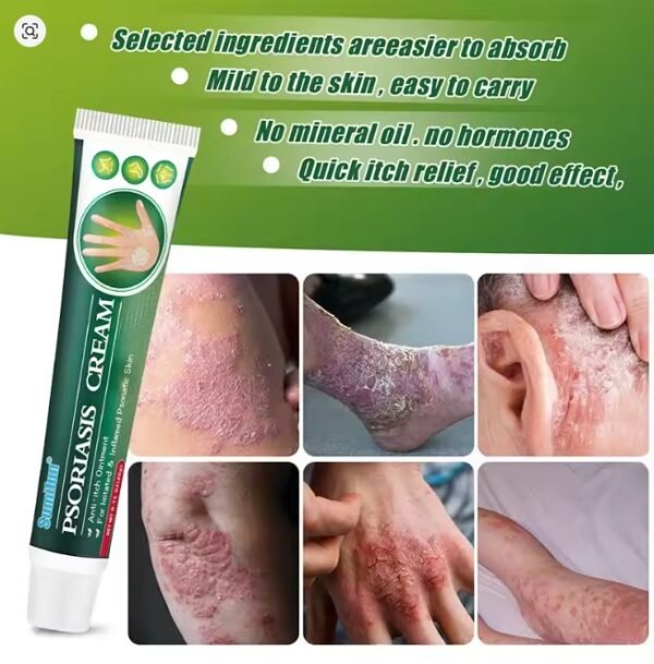 ⁦Sumifun الطب الصدفية الصينية كريم العناية بالبشرة لالتهاب الجلد الأكزيما العلاج الشرى الطبية المضادة للحكة مرهم⁩ - الصورة ⁦4⁩